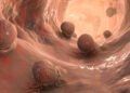 rectal cancer deaths young adults