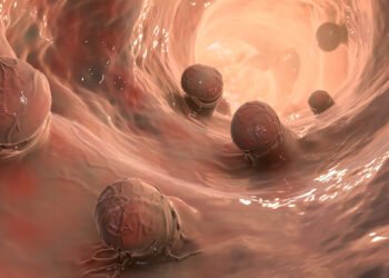 rectal cancer deaths young adults