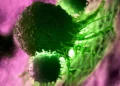 pancreatic cancer vaccine